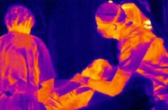 紅外熱像儀醫(yī)用的優(yōu)點-2